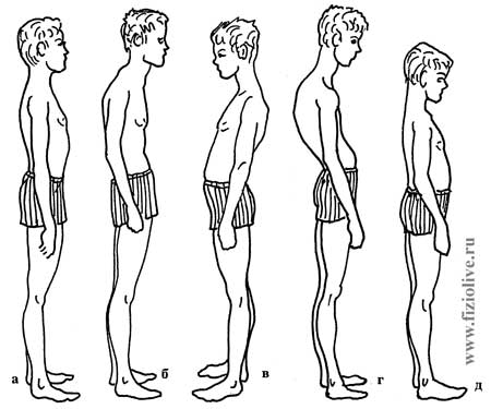 Types of posture
