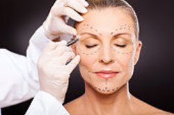 cosmetic surgeon marks the incision lines